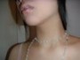 palpitation